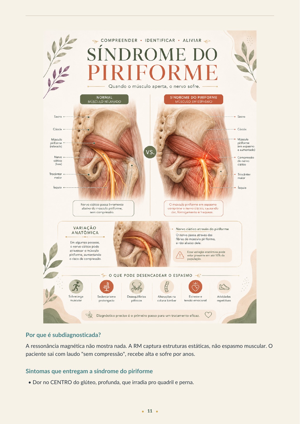 Página ilustrada sobre síndrome do piriforme